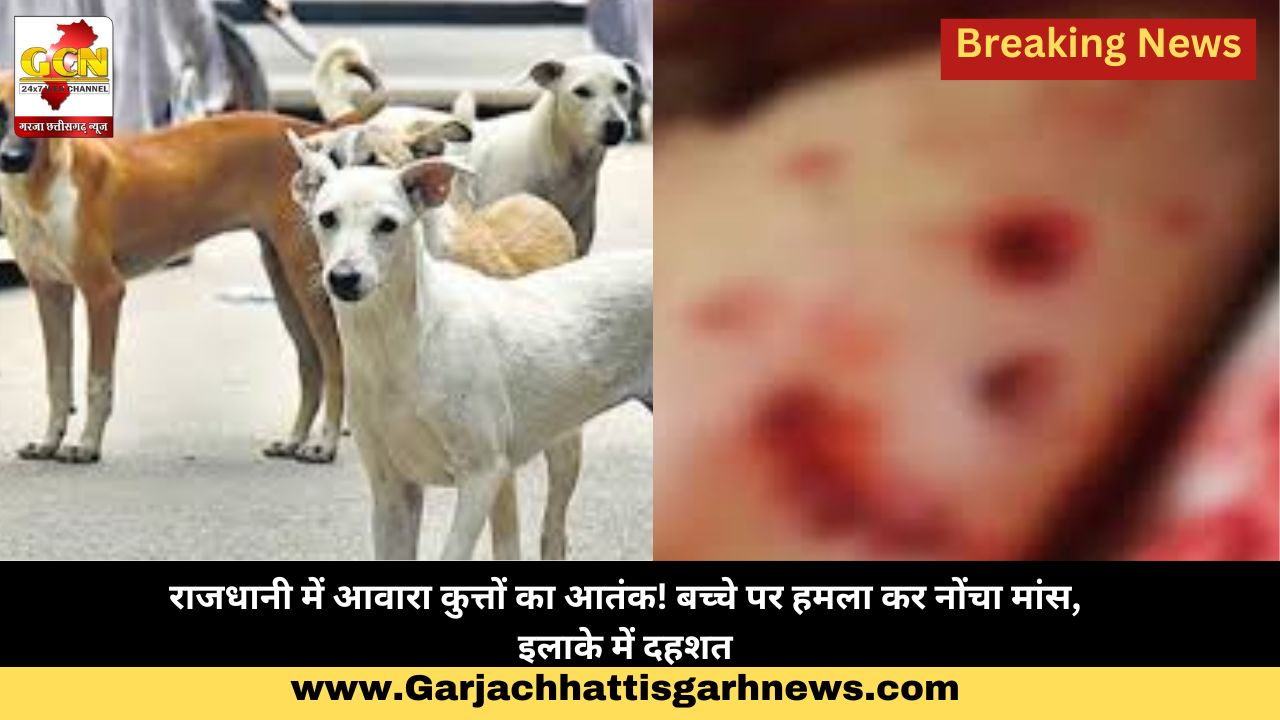 राजधानी में आवारा कुत्तों का आतंक! बच्चे पर हमला कर नोंचा मांस, इलाके में दहशत राजधानी में आवारा कुत्तों का आतंक! बच्चे पर हमला कर नोंचा मांस, इलाके में दहशत