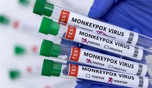 भारत में मंकीपॉक्स का खौफ, केंद्र सरकार ने जारी किया अलर्ट, स्वास्थ्य मंत्रालय ने दी ये खास सलाह भारत में मंकीपॉक्स का खौफ, केंद्र सरकार ने जारी किया अलर्ट, स्वास्थ्य मंत्रालय ने दी ये खास सलाह