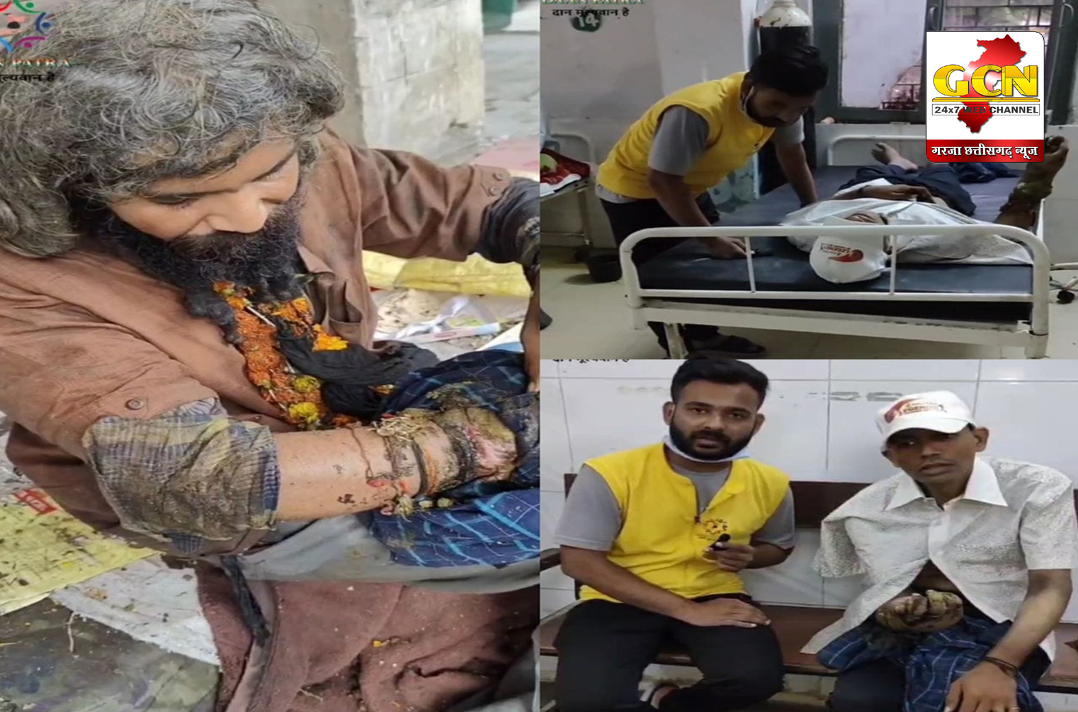 हाथों में लग रही थी सड़न, शरीर व बालों में पड़ रहे थे कीड़े, संस्था दानपात्र ने सही समय पर इलाज करवा बदली फुटपाथ पर मिले युवा की जिंदगी हाथों में लग रही थी सड़न, शरीर व बालों में पड़ रहे थे कीड़े, संस्था दानपात्र ने सही समय पर इलाज करवा बदली फुटपाथ पर मिले युवा की जिंदगी