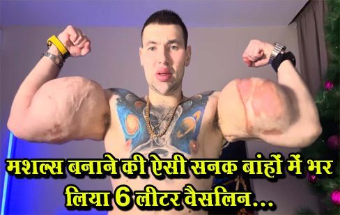 मशल्स बनाने की ऐसी सनक बांहों में भर लिया 6 लीटर वैसलिन...