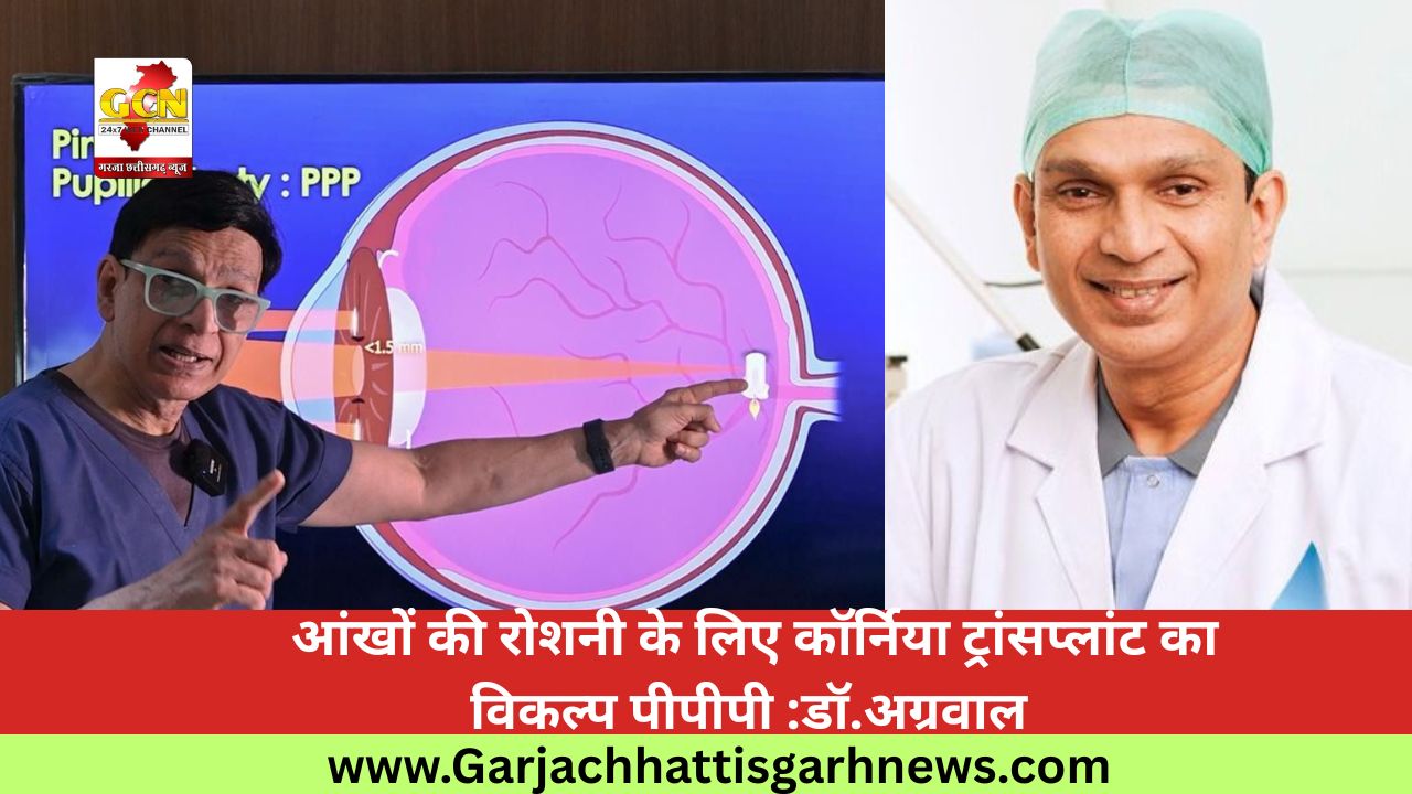आंखों की रोशनी के लिए कॉर्निया ट्रांसप्लांट का विकल्प पीपीपी :डॉ.अग्रवाल आंखों की रोशनी के लिए कॉर्निया ट्रांसप्लांट का विकल्प पीपीपी :डॉ.अग्रवाल