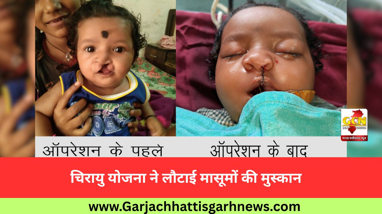 चिरायु योजना ने लौटाई मासूमों की मुस्कान चिरायु योजना ने लौटाई मासूमों की मुस्कान